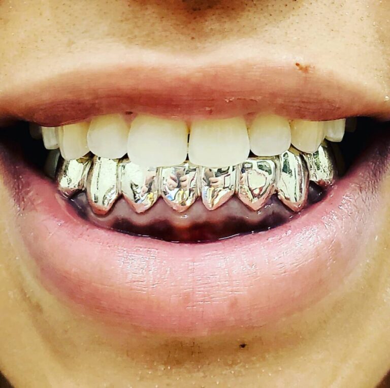 Silver Grillz Gold Grillz Miami Official site (305) 9896479