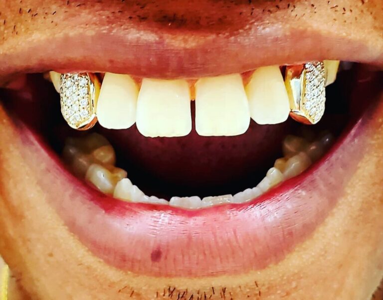ONLINE STORE Gold Grillz Miami Official site (305) 9896479 The